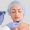 Blefaroplastia con cirugía Luxxia Clinic Barcelona