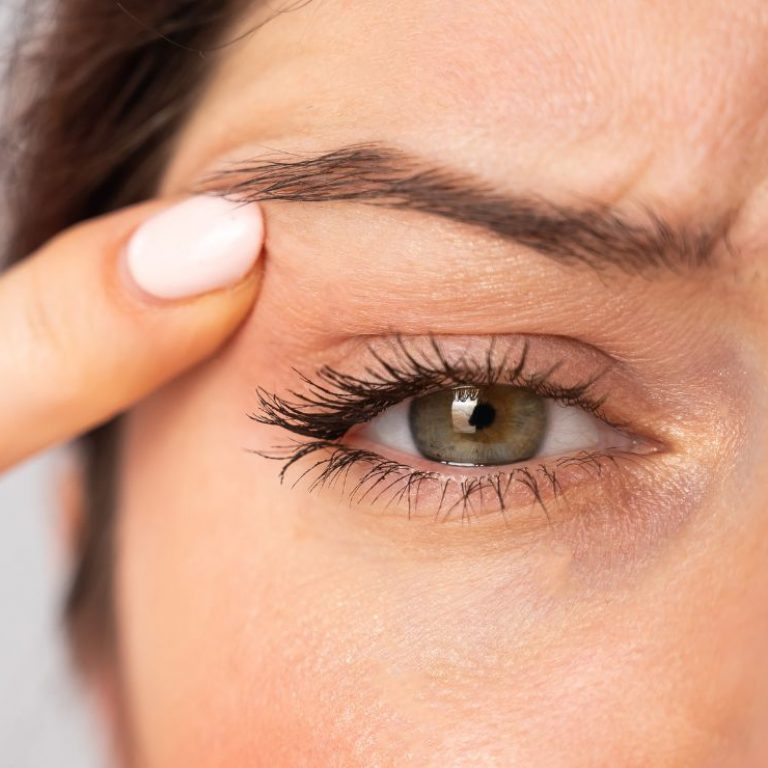 Blefaroplastia sin cirugía Luxxia Clinic Barcelona