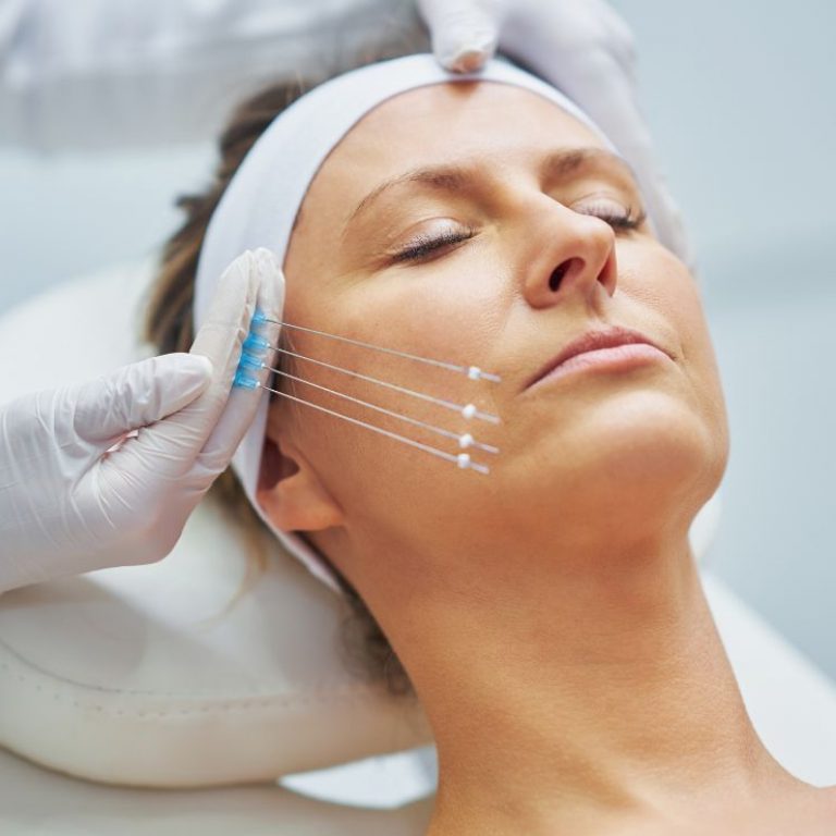 Hilos Tensores Luxxia Clinic Barcelona