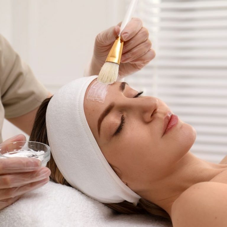 peeling quimico en foios valencia